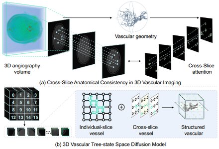 VasTSD: Learning 3D Vascular Tree-state Space Diffusion Model for Angiography Sy